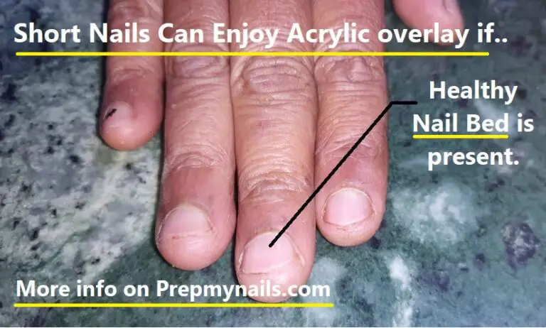 Are My Nails too Short for Acrylics Overlay on Short Bitten Nails