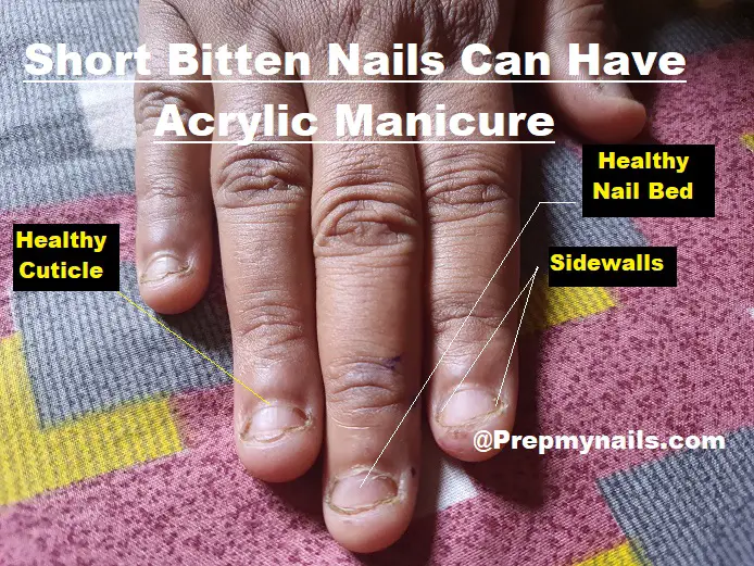 How Long Does Acrylic Nails Last On Bitten Nails? - Prep My Nails