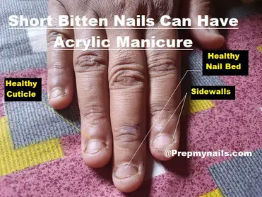 Are My Nails too Short for Acrylics? Overlay on Short Bitten Nails