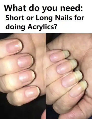 BITTEN NAILS GET ACRYLICS 